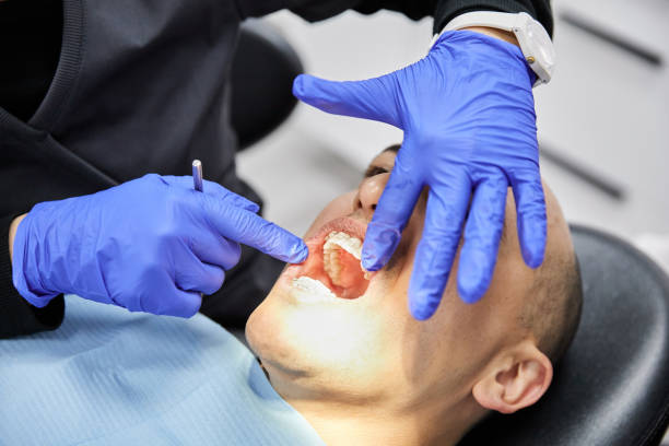 Best Emergency Treatment for Oral Infections in Capitol View, SC